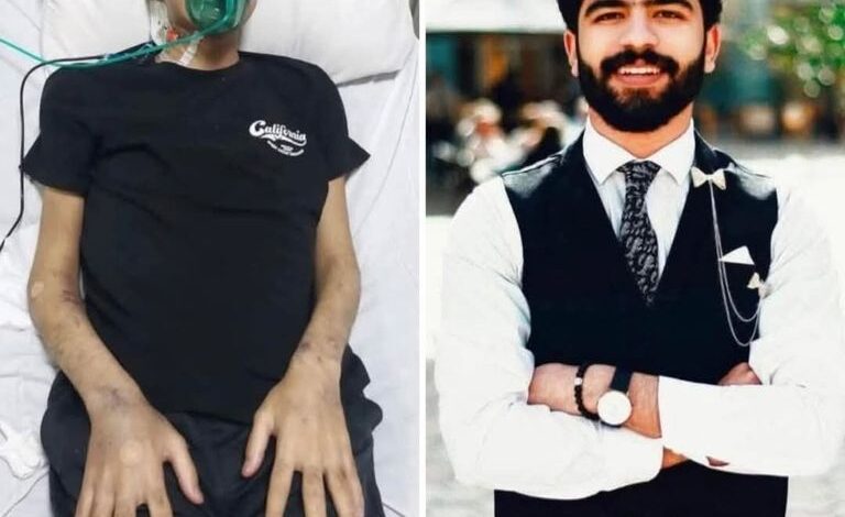 كم عمر محمد عبد الله المصور المصري؟