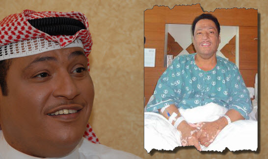 ما هو مرض الفنان ولد الديرة؟ إليك تفاصيل حالته الصحية